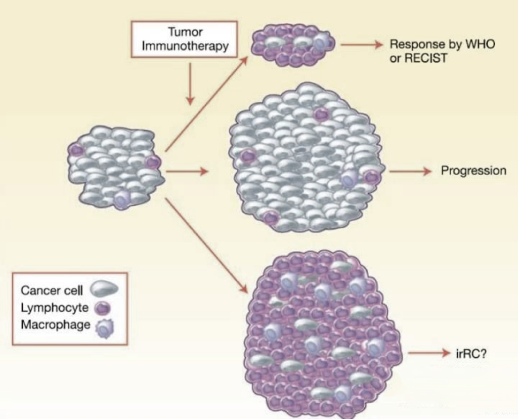 Tumor-Inflitrated-by-Various-Immune-Cells